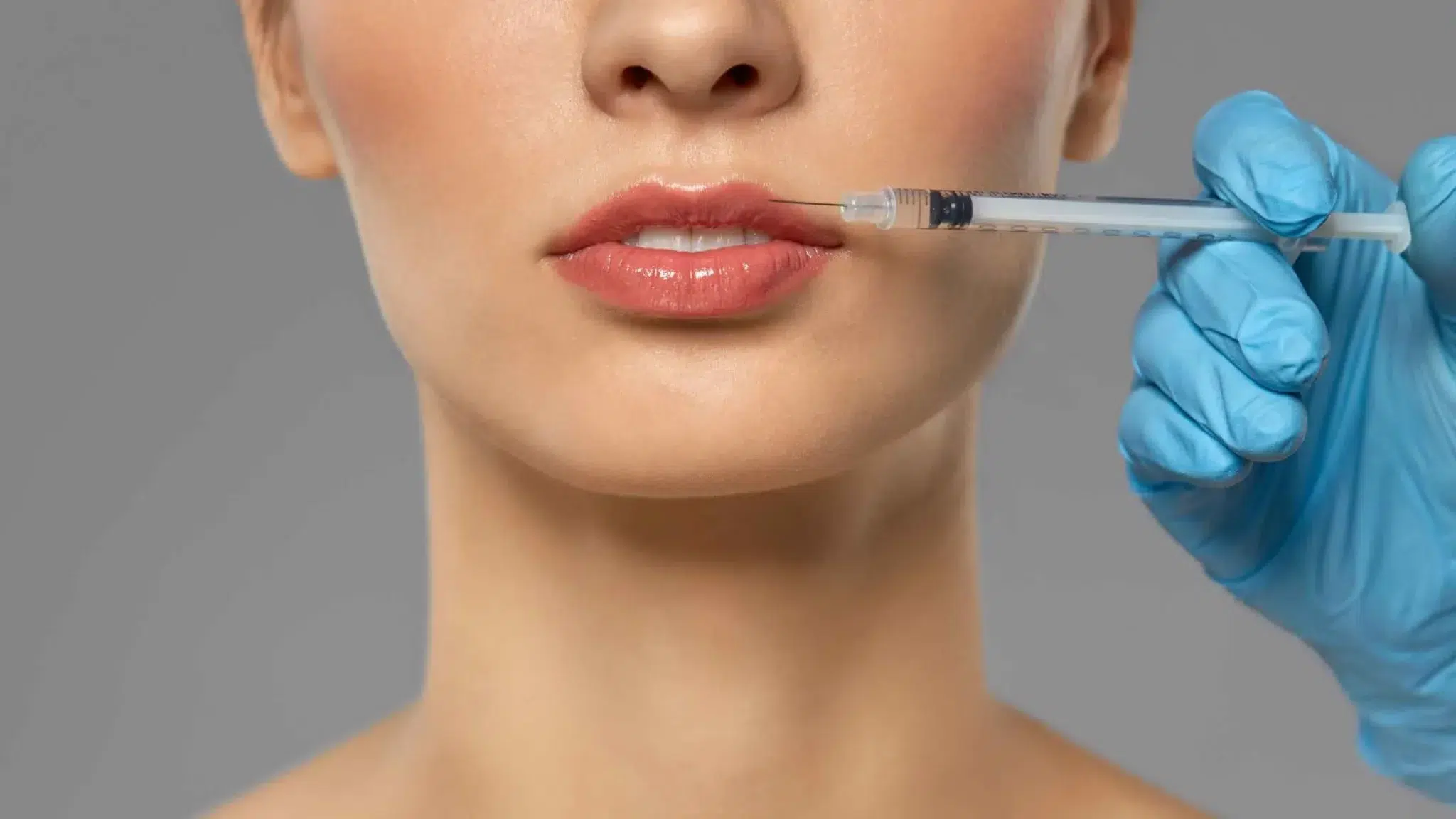 Lip Fillers in Los Angeles