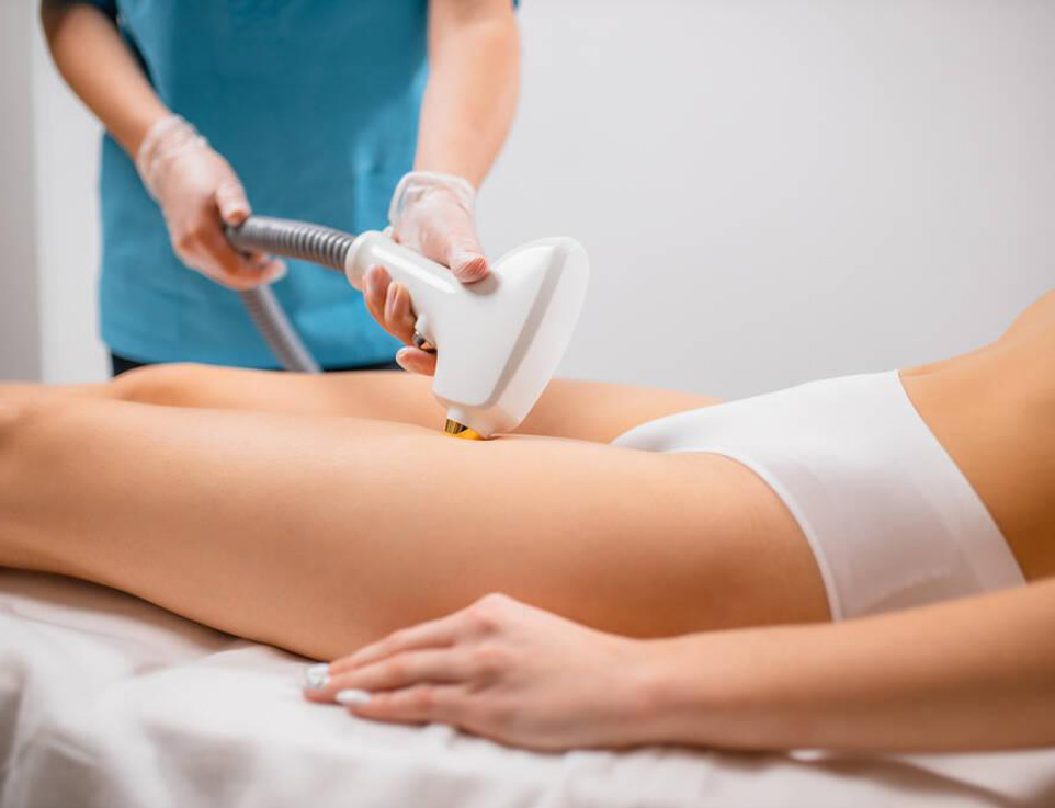 Laser Hair Removal LA