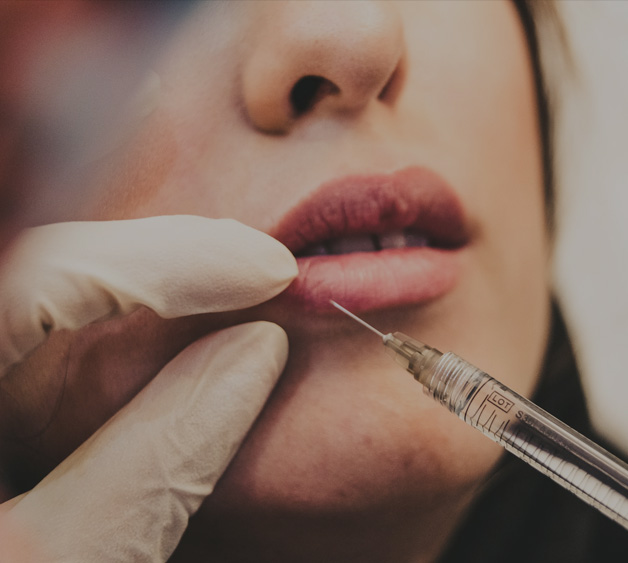 lip-injections-fillers