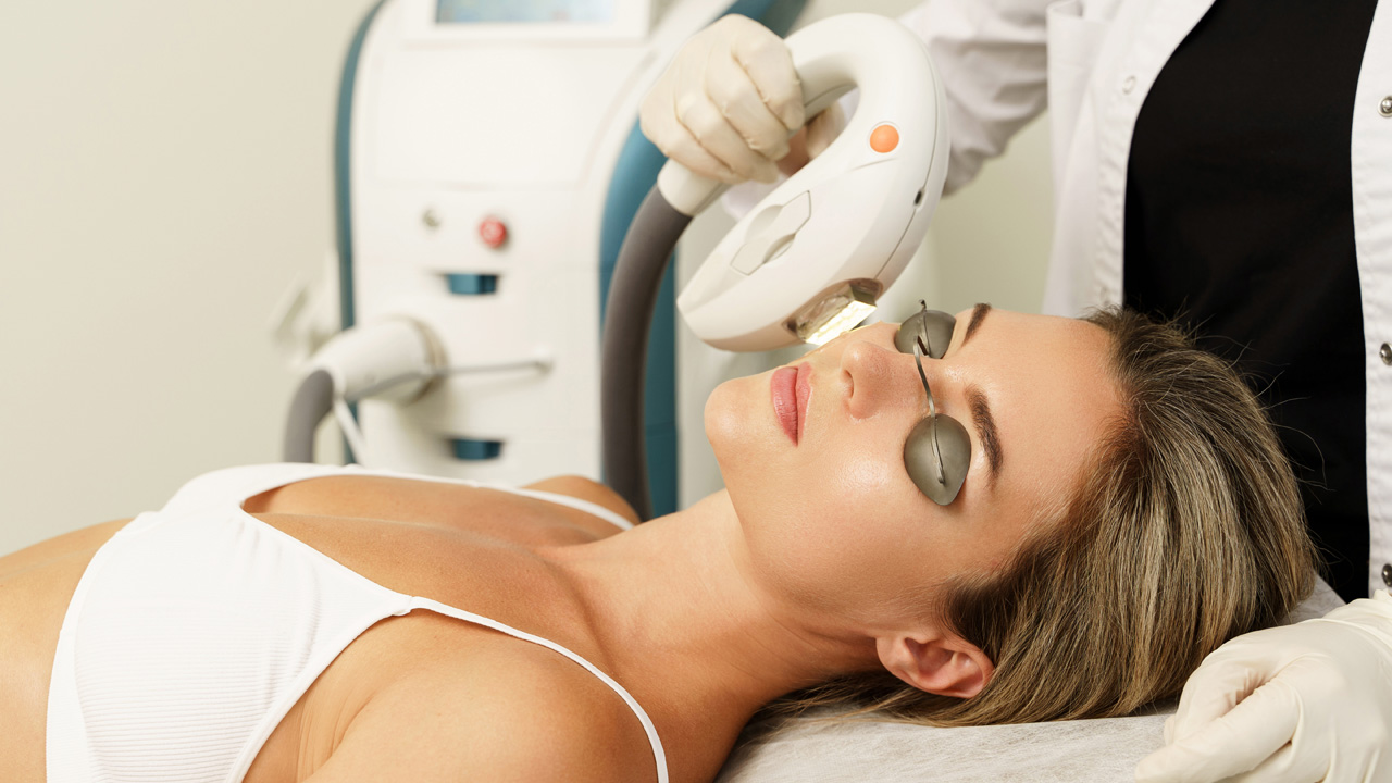 IPL photofacial