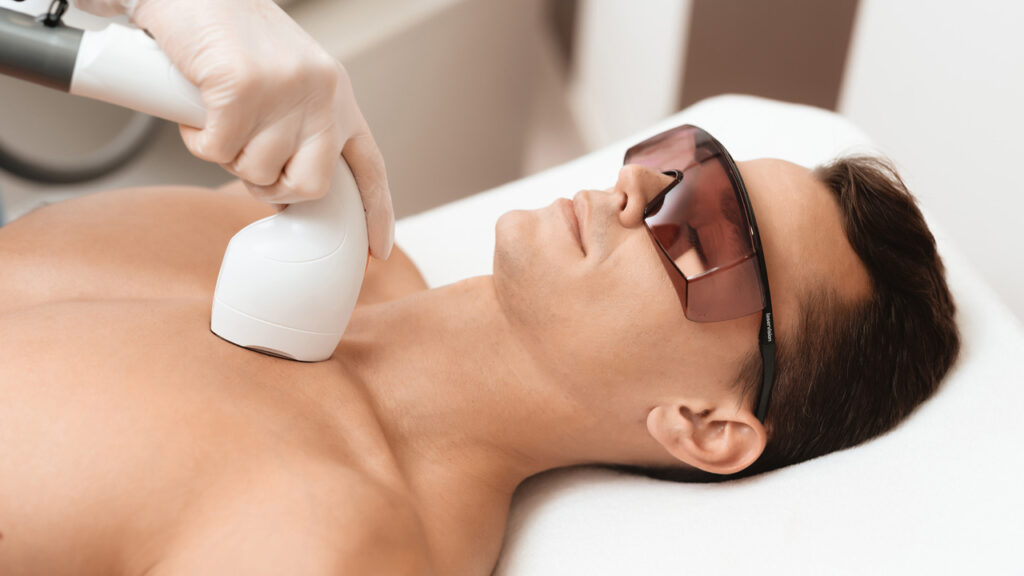 laser hair removal