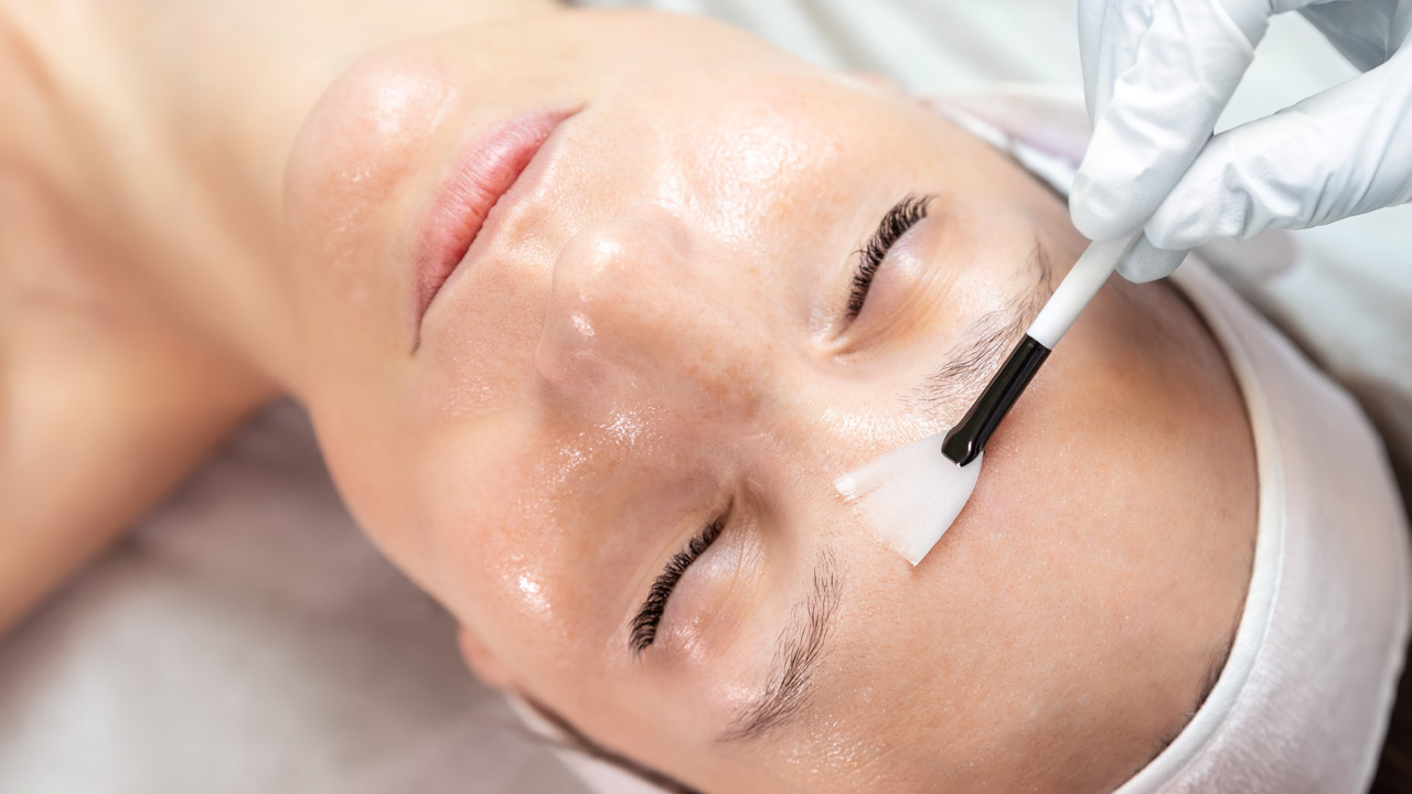 Chemical Peel treatments in our Los Angeles med spa