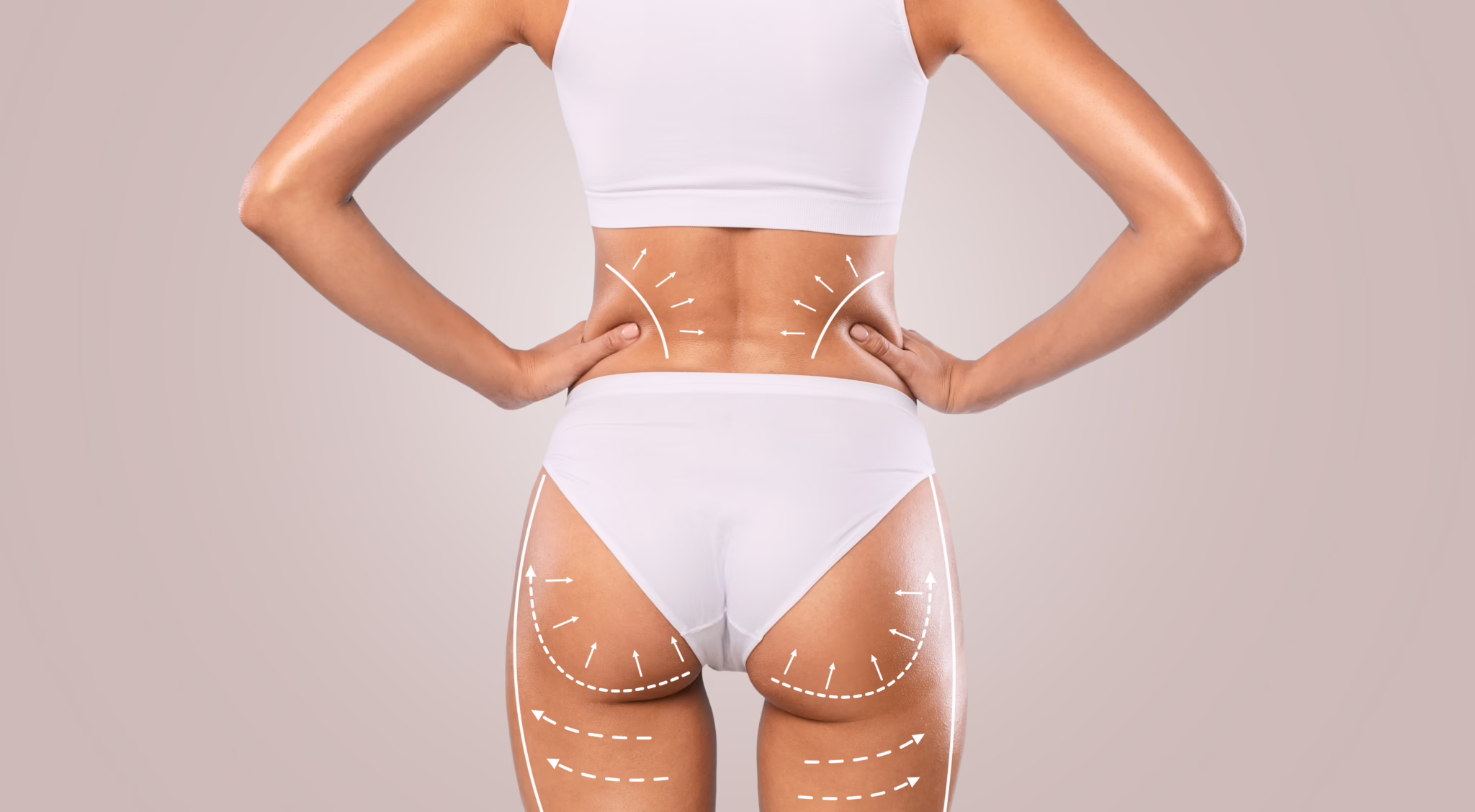 e-sculpt-muscle-body-contouring