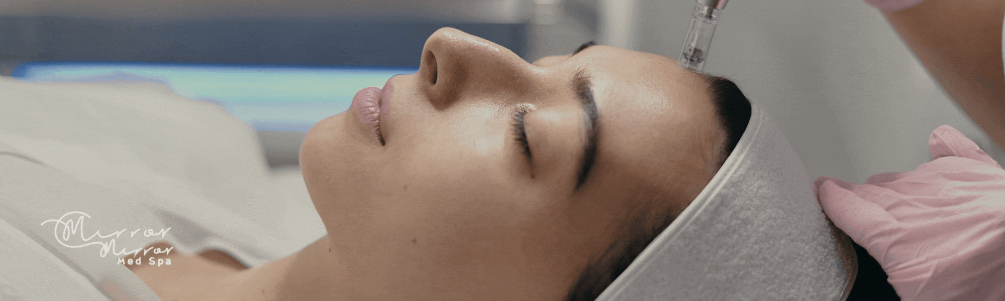Exosome Therapy & RF Microneedling