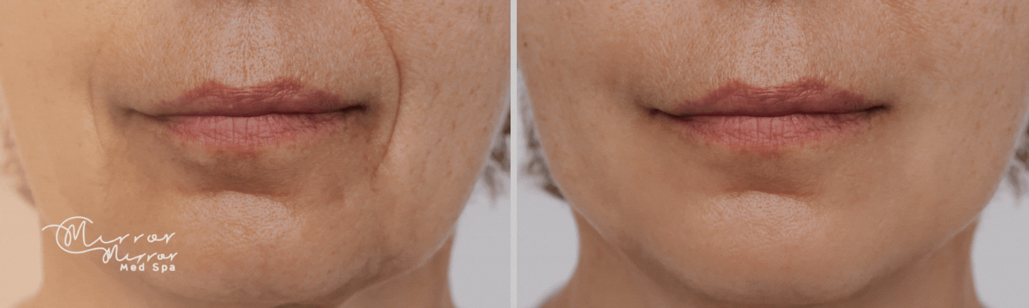 Transparent pricing for transformative skin remodeling