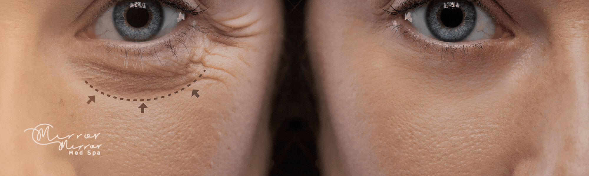 Three technologies, one goal: tighter, lifted, confident skin