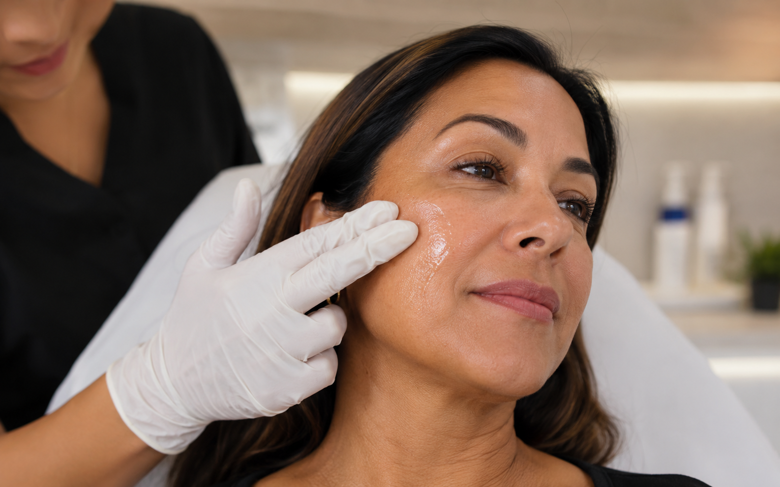 Provider applying exosome serum across the cheek after microneedling